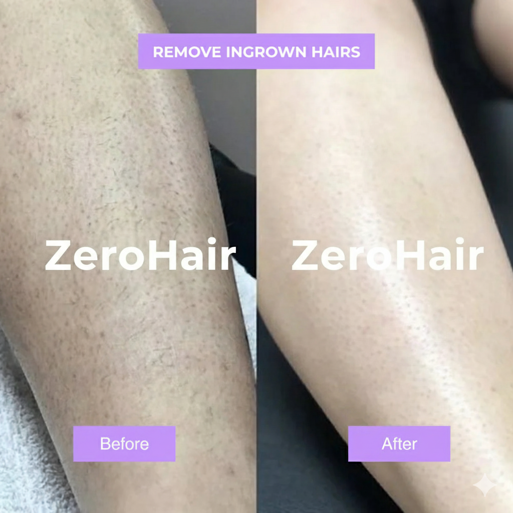 ZeroHair Cyperus Rotundus Skin Serum Natural Hair Removal Oil