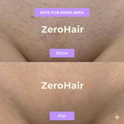 ZeroHair Cyperus Rotundus Skin Serum Natural Hair Removal Oil